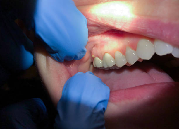 Best Tooth Pain Emergency Relief  in Laingsburg, MI