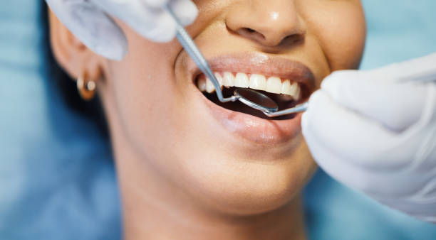 Best Urgent Tooth Repair  in Laingsburg, MI